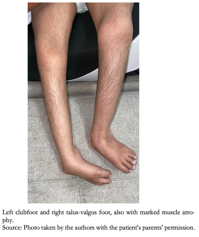 <b> Figure 4. </b> Photograph of lower limbs.