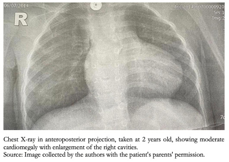 <b> Figure 6. </b> Chest X-ray.